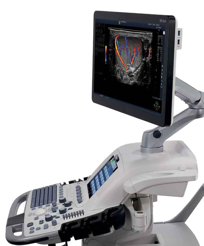 High-Quality GE Logiq E9 Ultrasound System